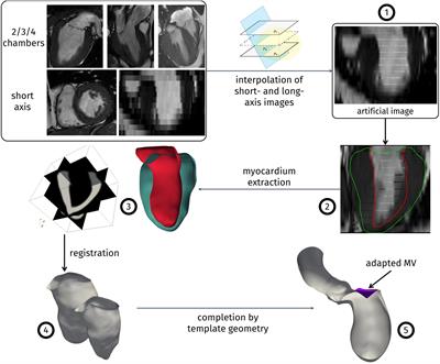 Image-Based Computational Hemodynamics Analysis of Systolic Obstruction in Hypertrophic Cardiomyopathy